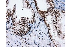 Immunohistochemical staining of paraffin-embedded Kidney tissue using anti-RC204952 mouse monoclonal antibody. (XRCC1 anticorps)