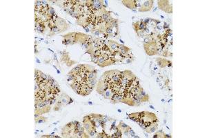 Immunohistochemistry of paraffin-embedded human stomach using CHIC2 antibody (ABIN6130103, ABIN6138533, ABIN6138534 and ABIN6223980) at dilution of 1:100 (40x lens). (CHIC2 anticorps  (AA 1-165))