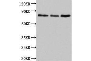 Western Blot Positive WB detected in: Jurkat whole cell lysate, Rat lung tissue, Mouse liver tissue All lanes: SUN2 antibody at 4. (SUN2 anticorps  (AA 45-155))
