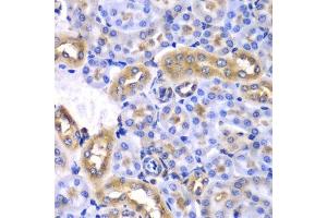 Immunohistochemistry of paraffin-embedded mouse kidney using SYNCRIP antibody. (SYNCRIP anticorps  (AA 1-200))