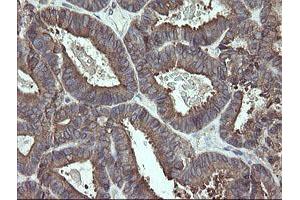 Image no. 9 for anti-Protein Disulfide Isomerase Family A, Member 3 (PDIA3) antibody (ABIN1498107)