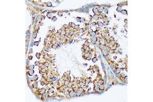 Immunohistochemistry of paraffin-embedded mouse testis using W/W/W Rabbit mAb (ABIN7271346) at dilution of 1:100 (40x lens). (WASF2 anticorps)