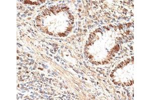 Immunohistochemistry of paraffin-embedded Human appendix using MCM5 Polyclonal Antibody at dilution of 1:100 (40x lens). (MCM5 anticorps)