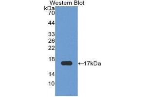 Western Blotting (WB) image for anti-Retinoic Acid Receptor Responder (Tazarotene Induced) 2 (RARRES2) (AA 33-158) antibody (ABIN3201548)
