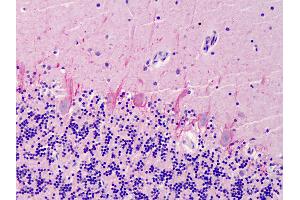 Anti-SUMO2/SUMO3 antibody IHC of human cerebellum.
