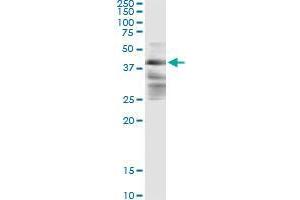 ZFYVE19 (Human) IP-WB Antibody Pair