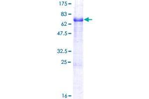 Image no. 1 for Transmembrane Protein with EGF-Like and Two Follistatin-Like Domains 1 (TMEFF1) (AA 1-380) protein (GST tag) (ABIN1322941)