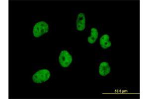Immunofluorescence of purified MaxPab antibody to FLJ12529 on HeLa cell. (CPSF7 anticorps  (AA 1-471))