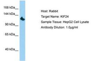 KIF24 anticorps  (AA 207-256)