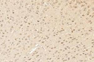 Immunohistochemistry analysis of paraffin-embedded mouse striatum using,RHOBTB3 (ABIN7075422) at dilution of 1: 3600 (RHOBTB3 anticorps)