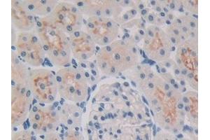 Detection of 15-LO-2 in Rat Kidney Tissue using Polyclonal Antibody to 15-Lipoxygenase-2 (15-LO-2) (ALOX15B anticorps  (AA 349-633))