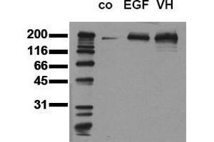 Western Blotting (WB) image for anti-Epidermal Growth Factor Receptor (EGFR) (pTyr1173) antibody (ABIN126779) (EGFR anticorps  (pTyr1173))