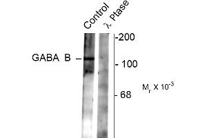 Western blots of rat synaptic membrane showing specific immunolabeling of the ~102 k GABAB R2 protein phosphorylated at Ser783 (control). (GABBR2 anticorps  (pSer783))