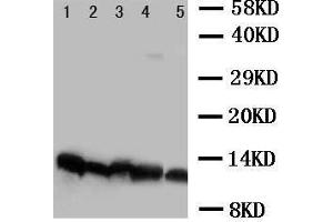 Anti-NDUFA1 antibody, Western blotting Lane 1: Rat Cardiac Muscle Tissue Lysate Lane 2: Rat Liver Tissue Lysate Lane 3: Rat Kidney Tissue Lysate Lane 4: Rat Brain Tissue Lysate Lane 5:  Cell Lysate (NDUFA1 anticorps  (C-Term))