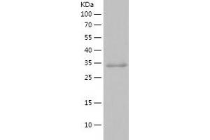 Western Blotting (WB) image for Syndecan 3 (SDC3) (AA 119-333) protein (His tag) (ABIN7125281)
