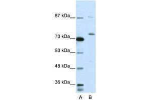 WB Suggested Anti-EXOSC10 Antibody Titration:  5. (EXOSC10 anticorps  (C-Term))