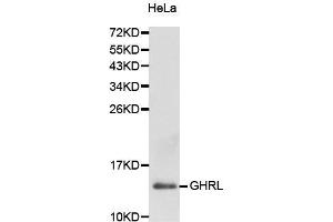 Western Blotting (WB) image for anti-Ghrelin (GHRL) (AA 1-117) antibody (ABIN3021901) (Ghrelin anticorps  (AA 1-117))