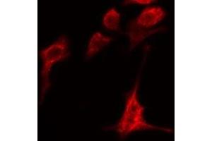 ABIN6279082 staining HeLa cells by IF/ICC. (ADAMTS1 anticorps  (Internal Region))