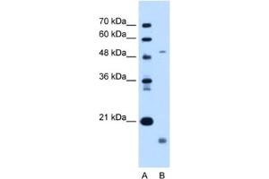 Western Blotting (WB) image for anti-Zinc Metalloproteinase, Ste24 (Zmpste24) antibody (ABIN2462996) (ZMPSTE24 anticorps)