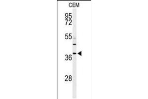 Western blot analysis of RNASEH2B Antibody in CEM cell line lysates (35ug/lane)