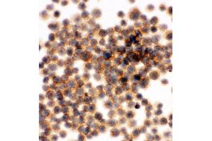 Anti-RIAM antibody, ICC ICC: JURKAT Cell