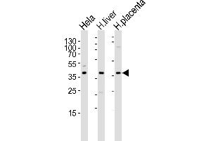 Western blot analysis of lysates from Hela cell line , human liver and placenta tissue lysate(from left to right), using OLR1 Antibody at 1:1000 at each lane.