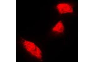 Immunofluorescent analysis of Cytokeratin 18 staining in A431 cells. (Cytokeratin 18 anticorps  (C-Term))