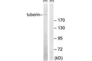 Western blot analysis of extracts from NIH-3T3 cells, using Tuberin (Ab-981) Antibody. (Tuberin anticorps  (AA 947-996))