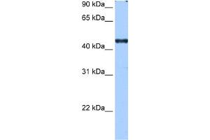 WB Suggested Anti-RBM42 Antibody Titration:  0. (RBM42 anticorps  (C-Term))