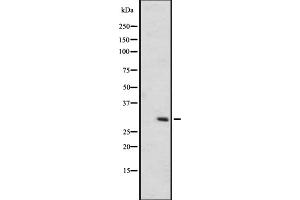 Western blot analysis of OR6C75 expression in A431 whole cell lysate ,The lane on the left is treated with the antigen-specific peptide. (OR6C75 anticorps)