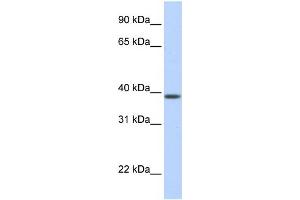 WB Suggested Anti-SLC25A42 Antibody Titration:  0. (SLC25A42 anticorps  (N-Term))