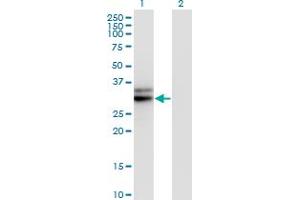 Western Blot analysis of HMGCL expression in transfected 293T cell line by HMGCL monoclonal antibody (M01), clone 4F4-D1.