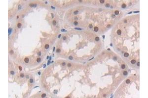 Detection of MAT2a in Human Kidney Tissue using Polyclonal Antibody to Methionine Adenosyltransferase II Alpha (MAT2a)