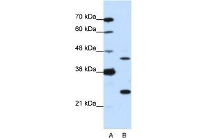 WB Suggested Anti-MINA Antibody Titration:  0. (MINA anticorps  (N-Term))
