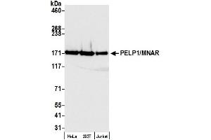 Western Blotting (WB) image for anti-Proline-, Glutamic Acid- and Leucine-Rich Protein 1 (PELP1) (AA 1000-1050) antibody (ABIN7453550) (PELP1 anticorps  (AA 1000-1050))
