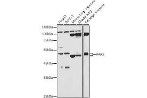 Western blot analysis of extracts of various cell lines, using P antibody (ABIN6132104, ABIN6140406, ABIN6140407 and ABIN6224794) at 1:1000 dilution. (F2RL1 anticorps  (AA 318-397))