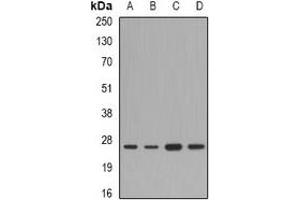 Western blot analysis of FAM173B expression in A549 (A), mouse liver (B), mouse heart (C), rat brain (D) whole cell lysates. (FAM173B anticorps)