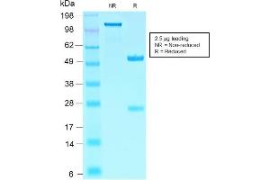 SDS-PAGE Analysis Purified SOX10-Monospecific Recombinant Rabbit Monoclonal Antibody (SOX10/2311R).