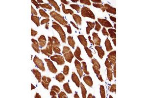 ACTA1/α-actin Antibody (C-term) immunohistochemistry analysis in formalin fixed and paraffin embedded human skeletal muscle followed by peroxidase conjugation of the secondary antibody and DAB staining.