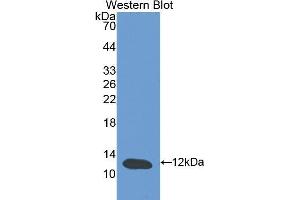 Western Blotting (WB) image for anti-Cystatin B (Stefin B) (CSTB) (AA 2-98) antibody (ABIN1077972) (CSTB anticorps  (AA 2-98))