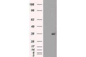 Image no. 6 for anti-Fc gamma RII (CD32) antibody (ABIN1497256) (Fc gamma RII (CD32) anticorps)