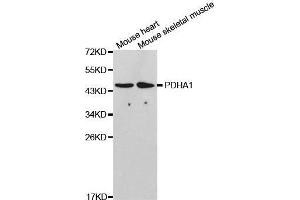 Western blot analysis of extracts of various cell lines, using PDHA1 antibody. (PDHA1 anticorps  (AA 30-390))