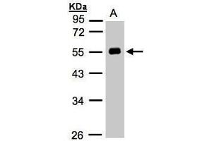 WB Image Sample(30 ug whole cell lysate) A:Hep G2 , 10% SDS PAGE antibody diluted at 1:1000