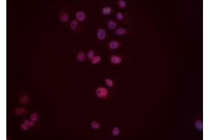 ABIN6276553 staining Hela cells by IF/ICC. (DUSP6 anticorps  (Internal Region))