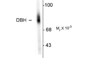 Western blots of human adrenal medulla lysate showing specific immunolabeling of the ~75k DBH protein.