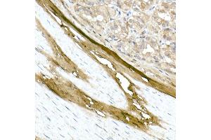Immunohistochemistry of paraffin-embedded rat stomach using Collagen I/COL1 Rabbit pAb (352) at dilution of 1:150 (40x lens).