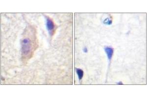 Immunohistochemistry analysis of paraffin-embedded human brain, using Bcr (Phospho-Tyr360) Antibody.