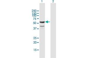 Western Blot analysis of CYP11B1 expression in transfected 293T cell line by CYP11B1 MaxPab polyclonal antibody. (CYP11B1 anticorps  (AA 1-574))