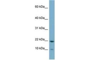 Image no. 1 for anti-Desumoylating Isopeptidase 1b (DESI1B) (C-Term) antibody (ABIN6741787) (DESI1 / PPPDE2 anticorps  (C-Term))