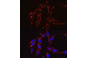 Immunofluorescence analysis of NIH/3T3 cells using SECISBP2 Rabbit pAb (ABIN6128699, ABIN6147497, ABIN6147498 and ABIN6222461) at dilution of 1:50 (40x lens).